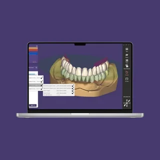 نرم افزار اگزوکد3.0  | exocad 3.0